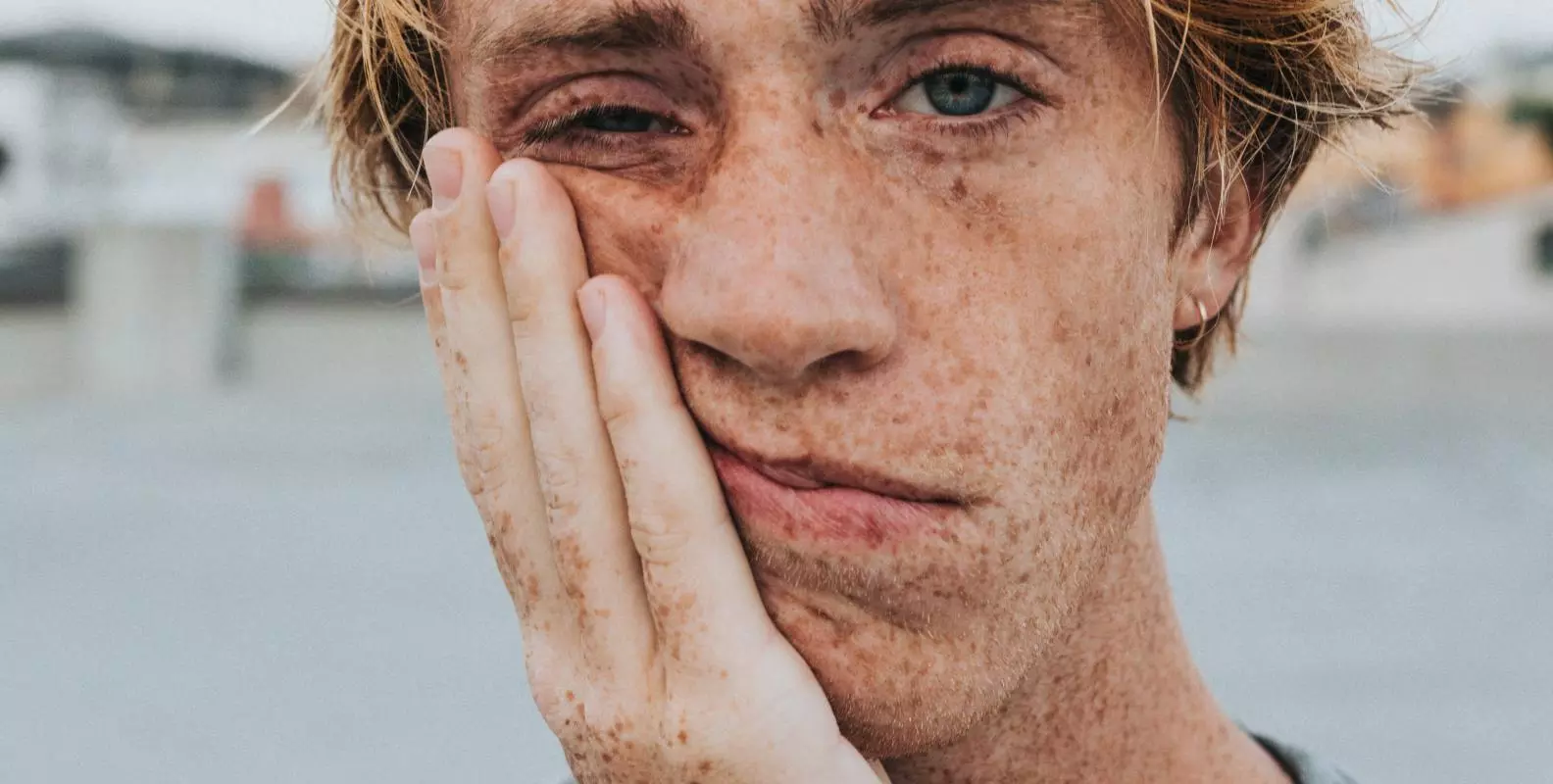 Photo of a young man with his head in his hand. He has lots of freckles and fair hair 